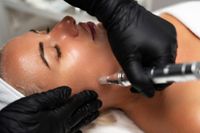 Apparative Gesichtsbehandlung im Beauty Room der Beauty Connection München in Ismaning: Kosmetikerin behandelt die Wange einer Kundin mit einem Needling-Handstück